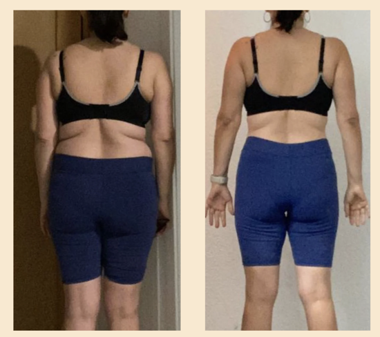 Depoimento de Ana, 49 anos