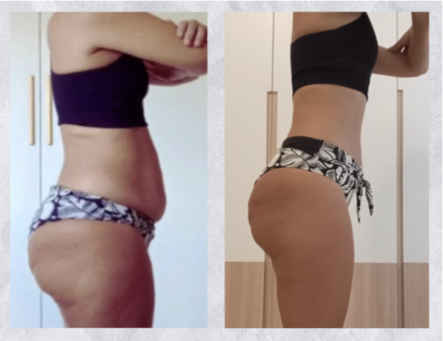 Depoimento de Aline, 45 anos