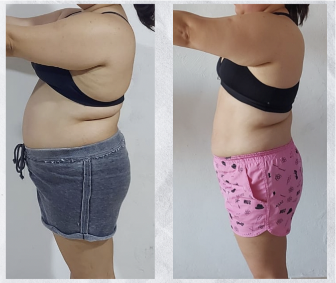 Depoimento de Diana, 38 anos